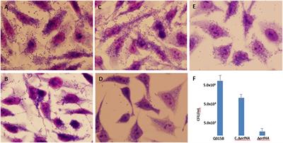 Transposon mutagenesis of atypical enteroaggregative Escherichia coli reveals a hemagglutinin-associated protein that mediates cell adhesion and contributes to the Galleria mellonella virulence